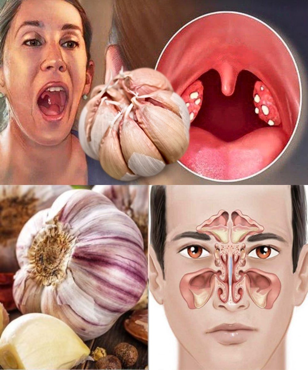 🧄 Garlic for Infections: 12 Proven Benefits & How to Use It Naturally 🌿