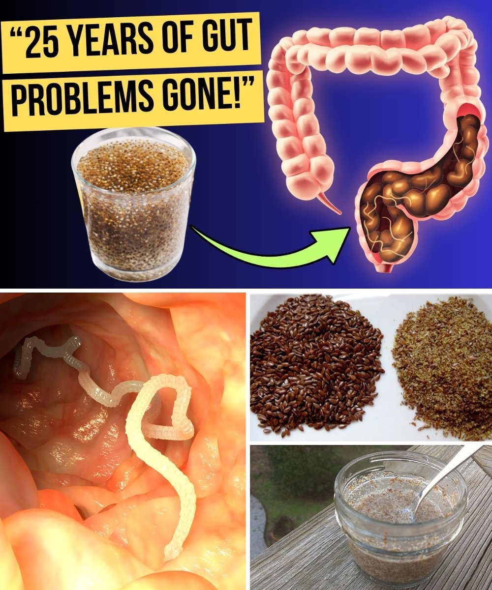 How to Get Rid of Intestinal Parasites (Recipe) – All Diseases Begin in the Gut! Here’s How to Heal Yours Naturally