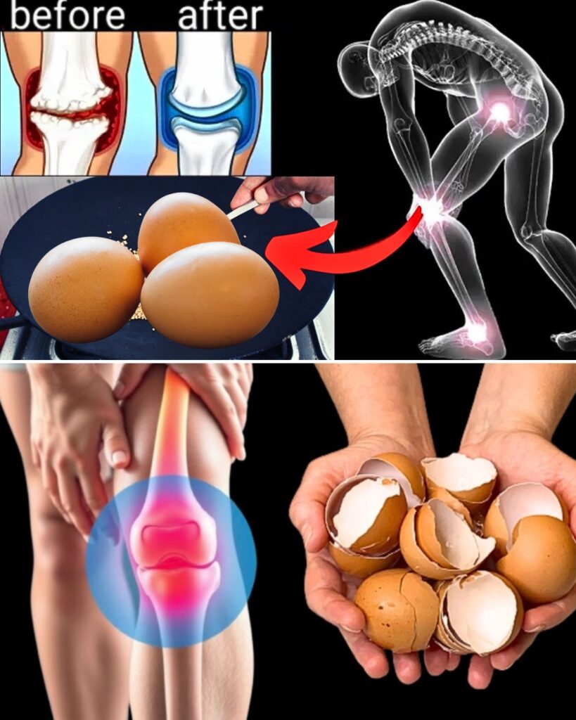 Don’t Ever Throw Away Eggshells Again After Reading This! You Won’t Believe How Useful They Are (Joint Recovery and More)