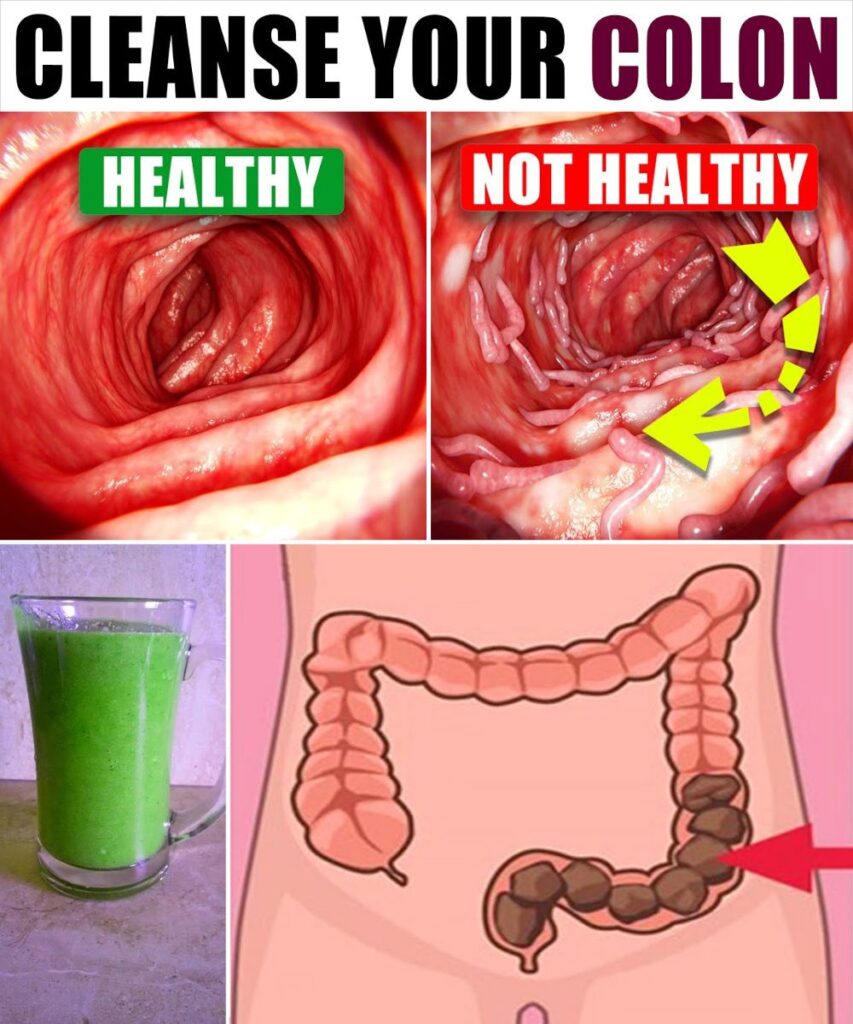 17 Natural Habits to Keep Your Colon Healthy