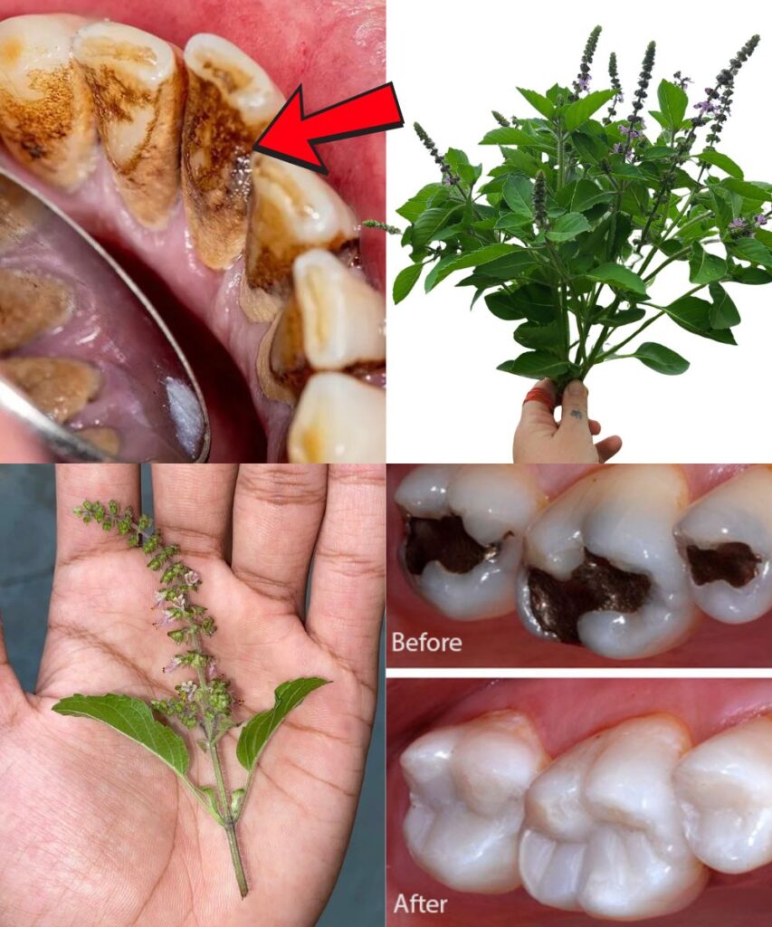  Holy Basil (Tulsi) for Oral Health: A Natural Remedy for Cavities, Gum Problems, Bad Breath & Stronger Teeth
