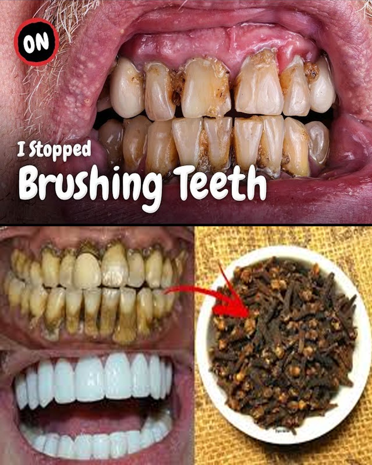 Discover Cloves: Your Secret to a Healthier Smile