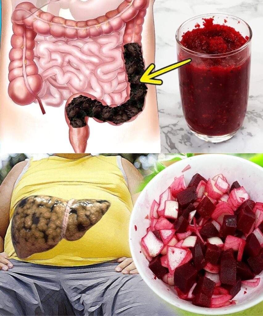 🍷 Cleanse Your Colon Naturally & Remove Fat from Your Liver with This Beetroot and Onion Drink