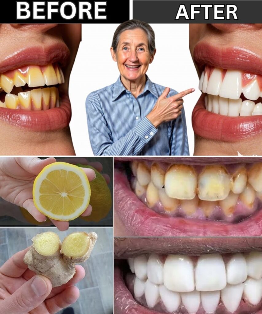 Say Goodbye to Dental Plaque Forever—Dentists Are Hiding It! 🦷✨