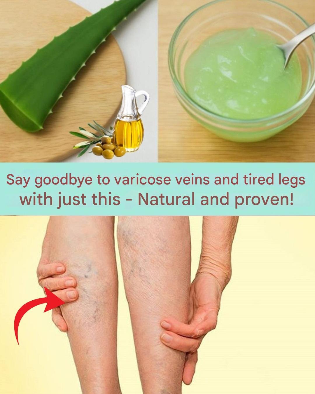 Aloe Vera for Varicose Veins and Tired Legs: Natural Relief You Can Try at Home