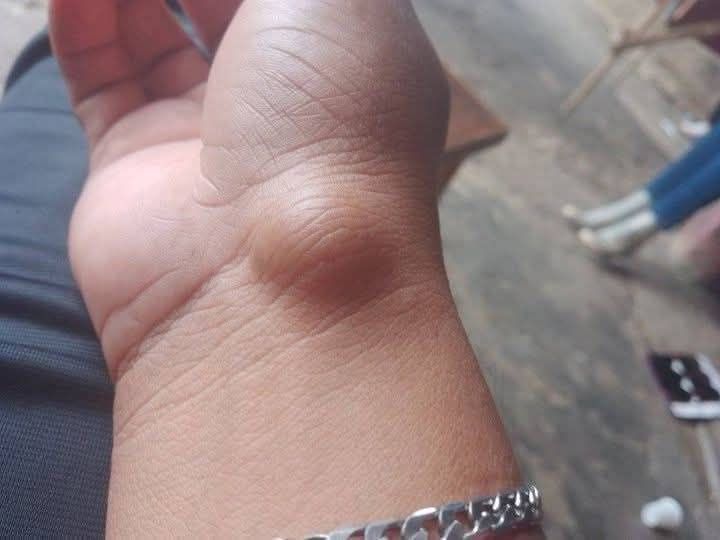 Adipose Tissue: The Body’s Energy Storage System