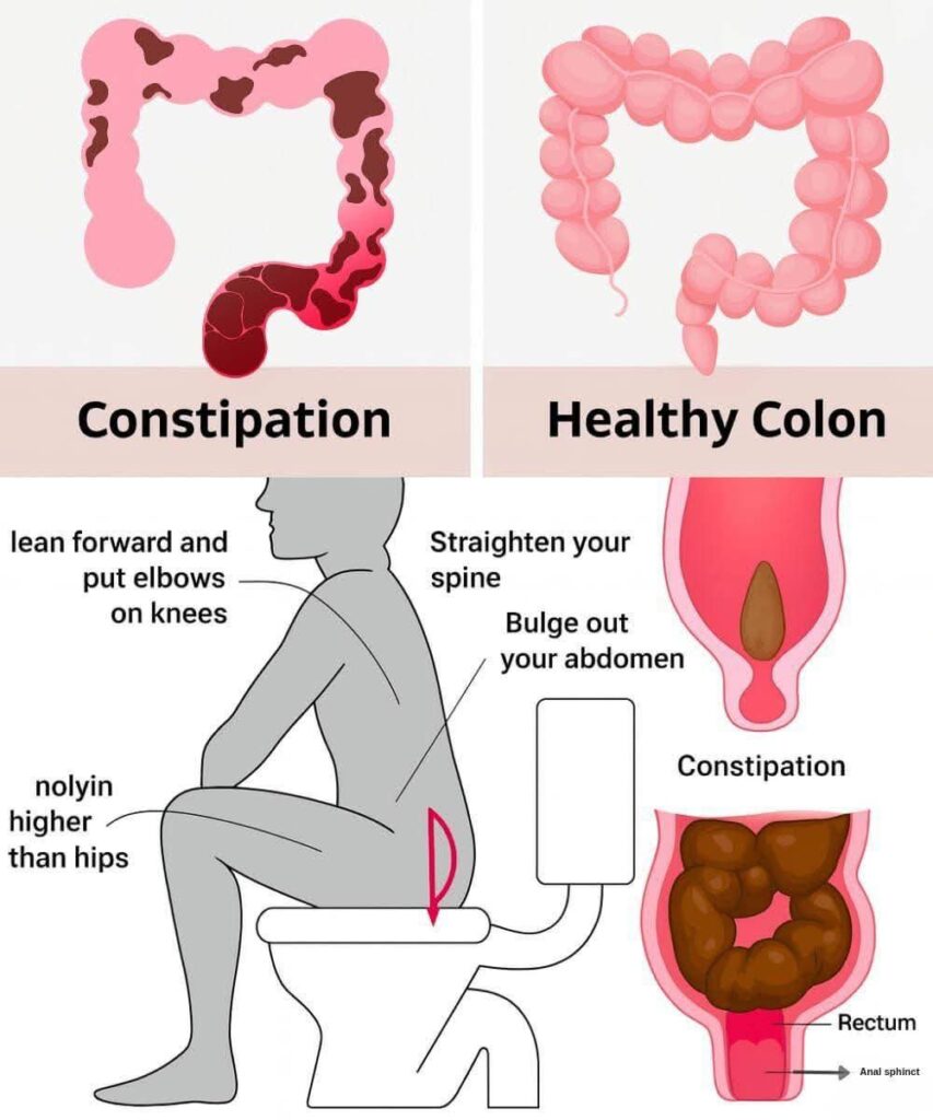 How to Clean Your Colon and Remove Waste Naturally