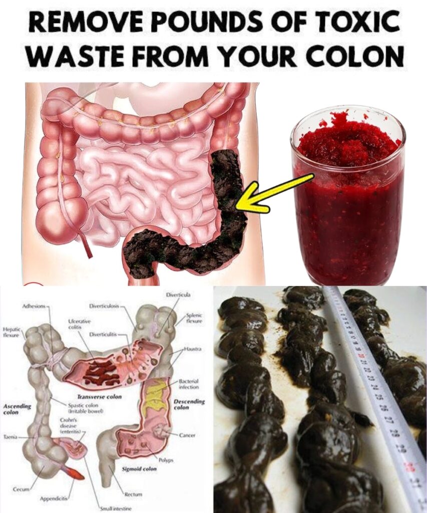 Cleanse Your Colon Naturally and Remove Fat From Your Liver With This Drink