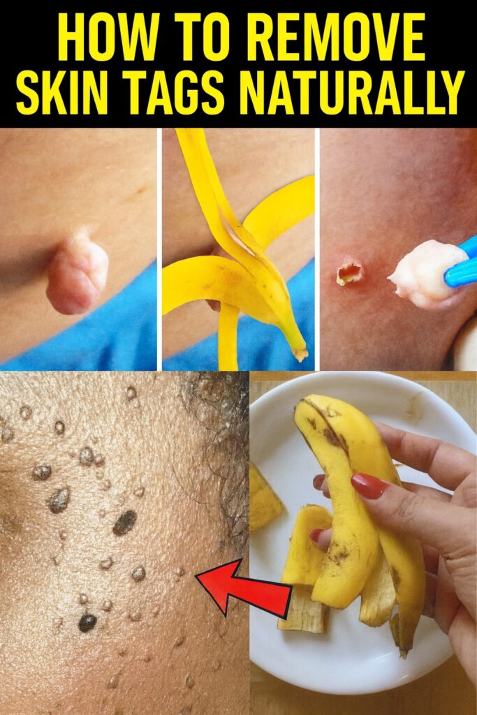Unlock the Hidden Power of Banana Peels for Radiant, Youthful Skin