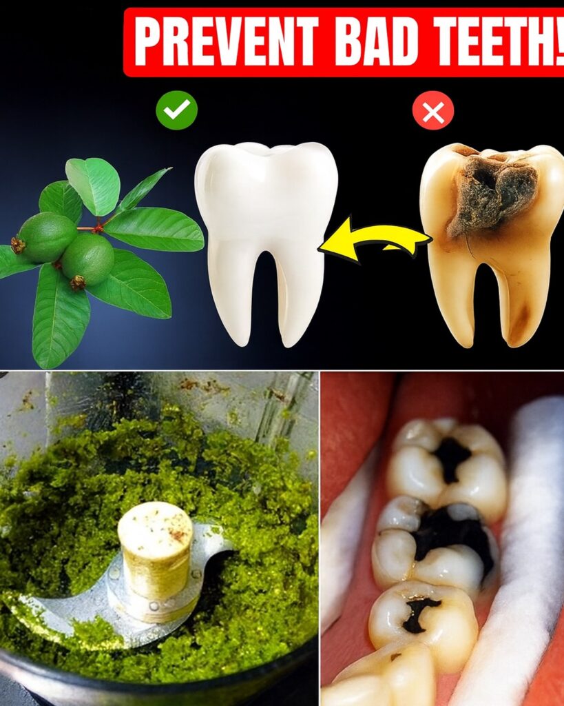 Unlock Nature’s Secret: Top 3 Guava Leaf Remedies to Fight Tooth Decay Naturally