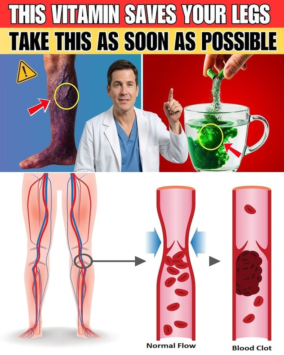 This Vitamin Could Help Reduce Blood Clot Risk in Your Legs – Seniors, Here’s What You Need to Know