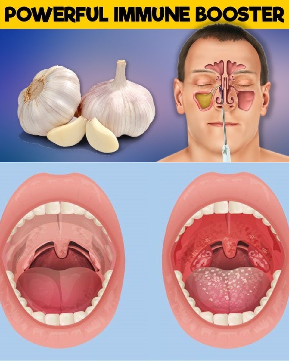 🧄 Garlic for Immunity and Urinary Health: A Gentle Natural Ally