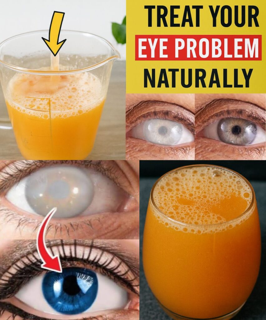 8 Natural Ways to Treat Eye Problems and Improve Your Vision Naturally