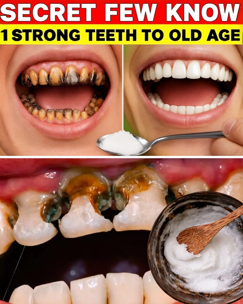 Coconut Oil: The Secret to White, Strong, and Healthy Teeth