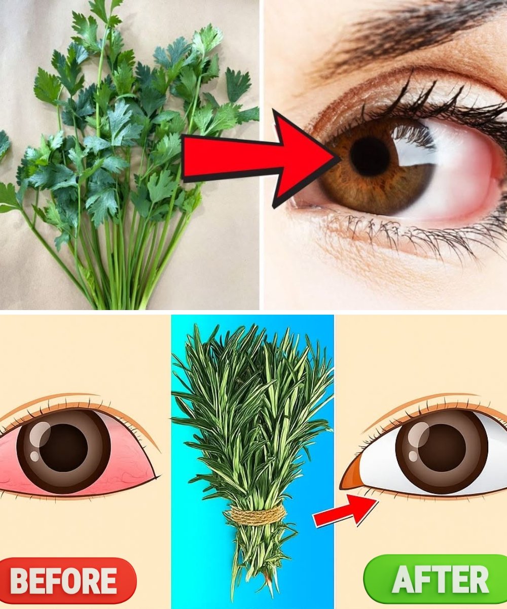 Unbelievable! Restore Your Vision Naturally with This Parsley Drink! 🌿👁️