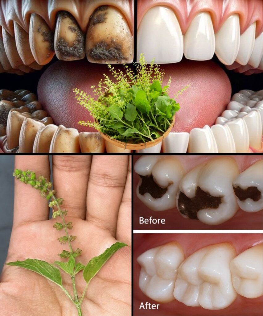 Unlock the Secret to a Radiant Smile: How Holy Basil (Tulsi) Transforms Your Oral Health! 🦷