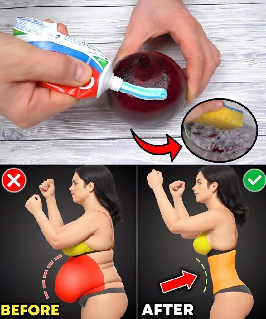 Lose Belly Fat Overnight: The Viral Onion and Toothpaste Remedy You Must Try