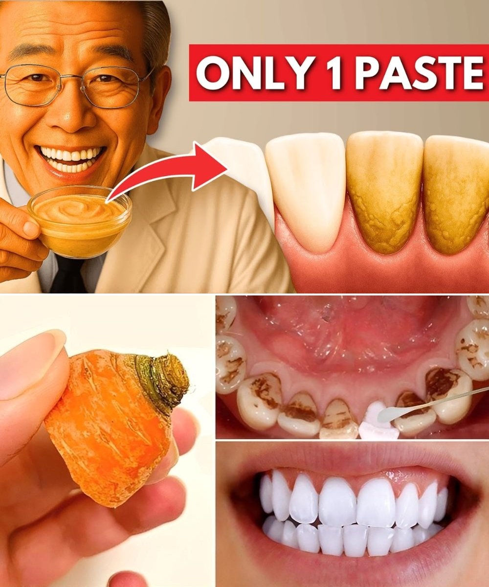 Japan's Oldest Doctor Reveals the #1 Natural Remedy for Dental Plaque and Stains After 60 — Without Chemicals