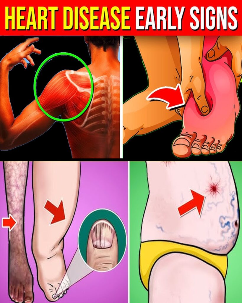 10 Warning Signs Your Heart Is Sending Before It’s Too Late + 7 Lifesaving Tips to Act Now!
