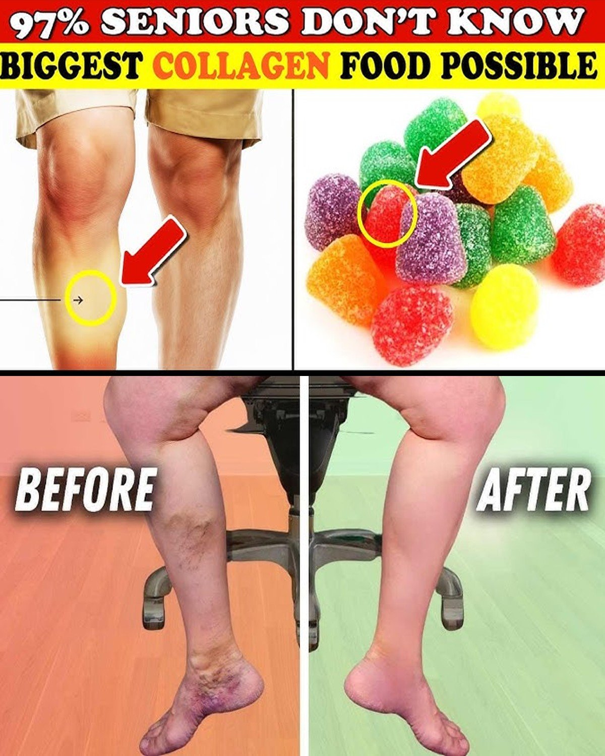 Say Goodbye to Swelling: 8 Collagen-Rich Foods for Legs