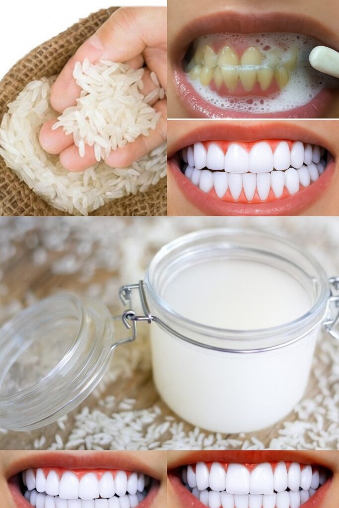 Brighten Your Smile Naturally with This Pantry Staple (No Harsh Chemicals!)