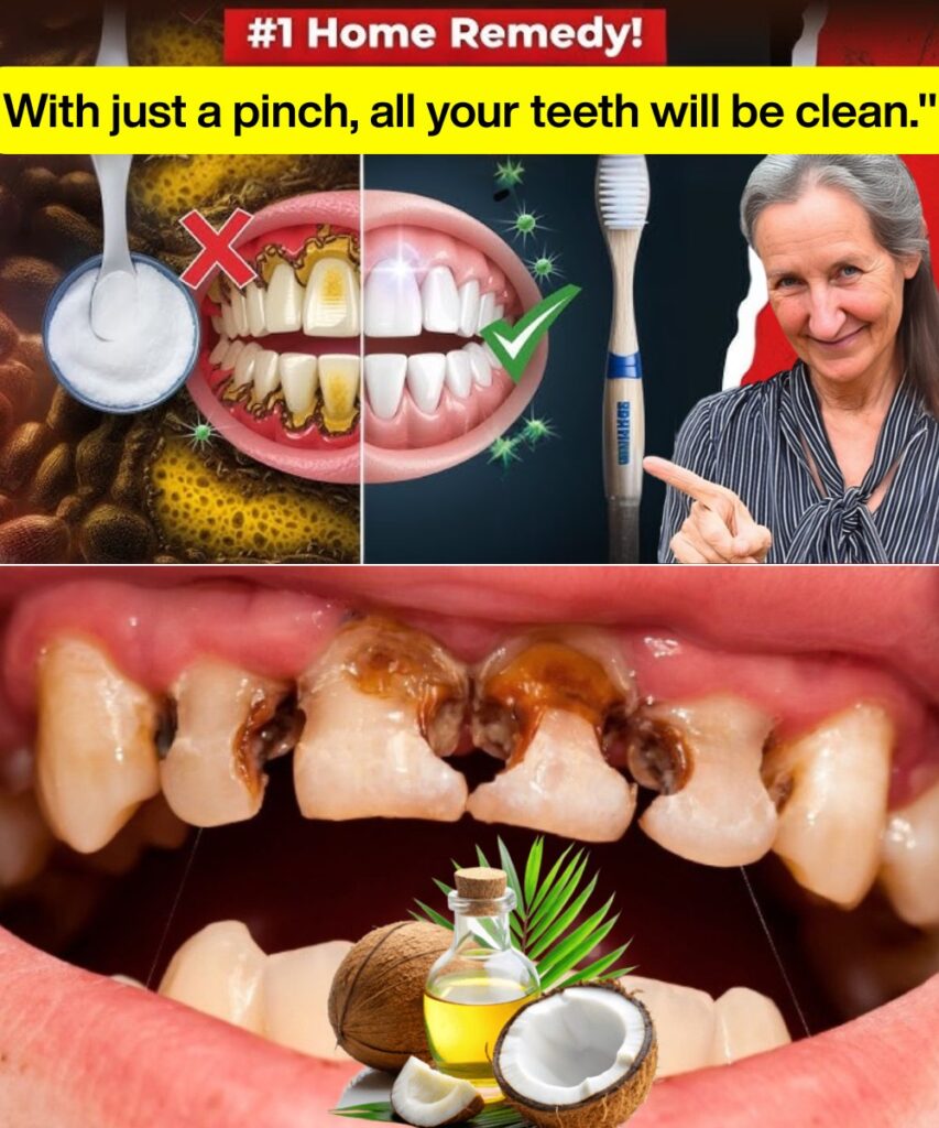 Unlock the Secret to a Radiant Smile: Coconut Oil’s Power for Perfect Teeth