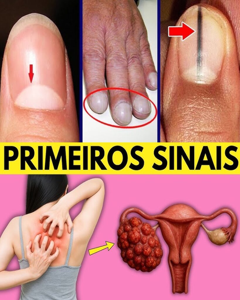 14 Silent Cancer Signals Women Can’t Ignore