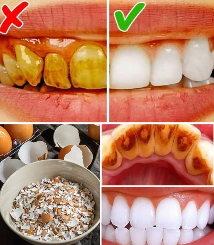  Unlock a Brighter Smile with an Unexpected Natural Ingredient: Eggshells