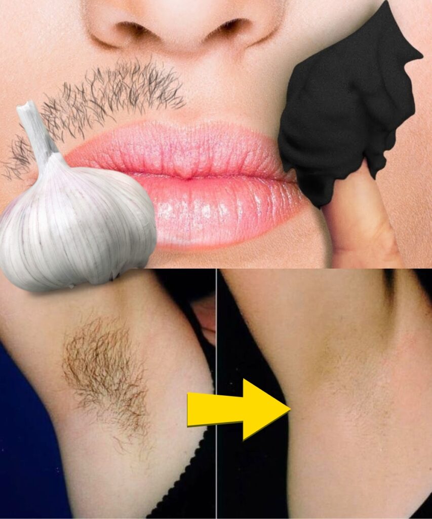 Stop Shaving! Discover Natural Ways to Permanently Remove Facial, Body, and Pubic Hair