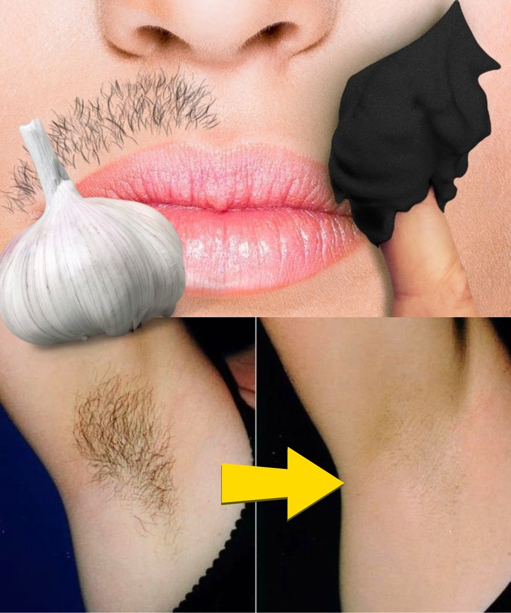 Stop Shaving! Discover Natural Ways to Permanently Remove Facial, Body, and Pubic Hair