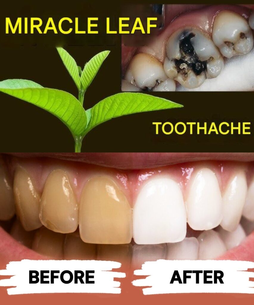 How to Whiten Teeth and Treat Cavities with Guava Leaves: A Natural, Effective Method