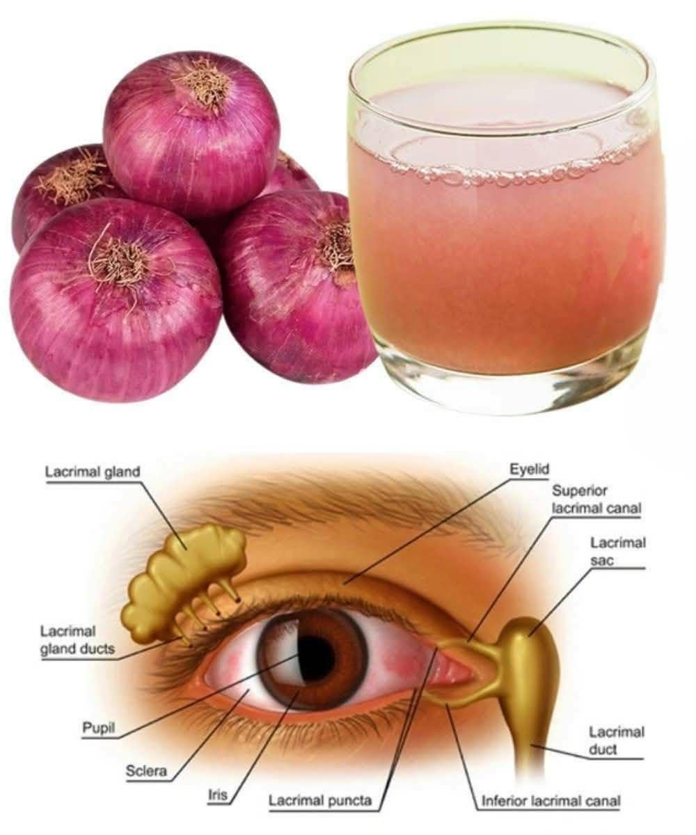 Can Onion Juice Gently Support Eye Health? A Natural Tip Worth Trying