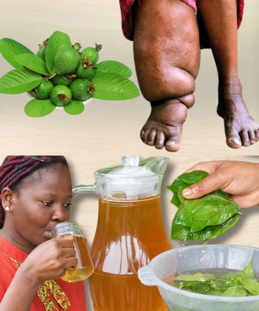  Guava Leaf Tea: The Ultimate Secret to Banishing Swollen Legs