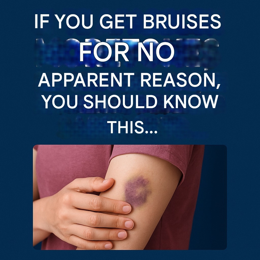 Why Do Unexplained Bruises Appear?