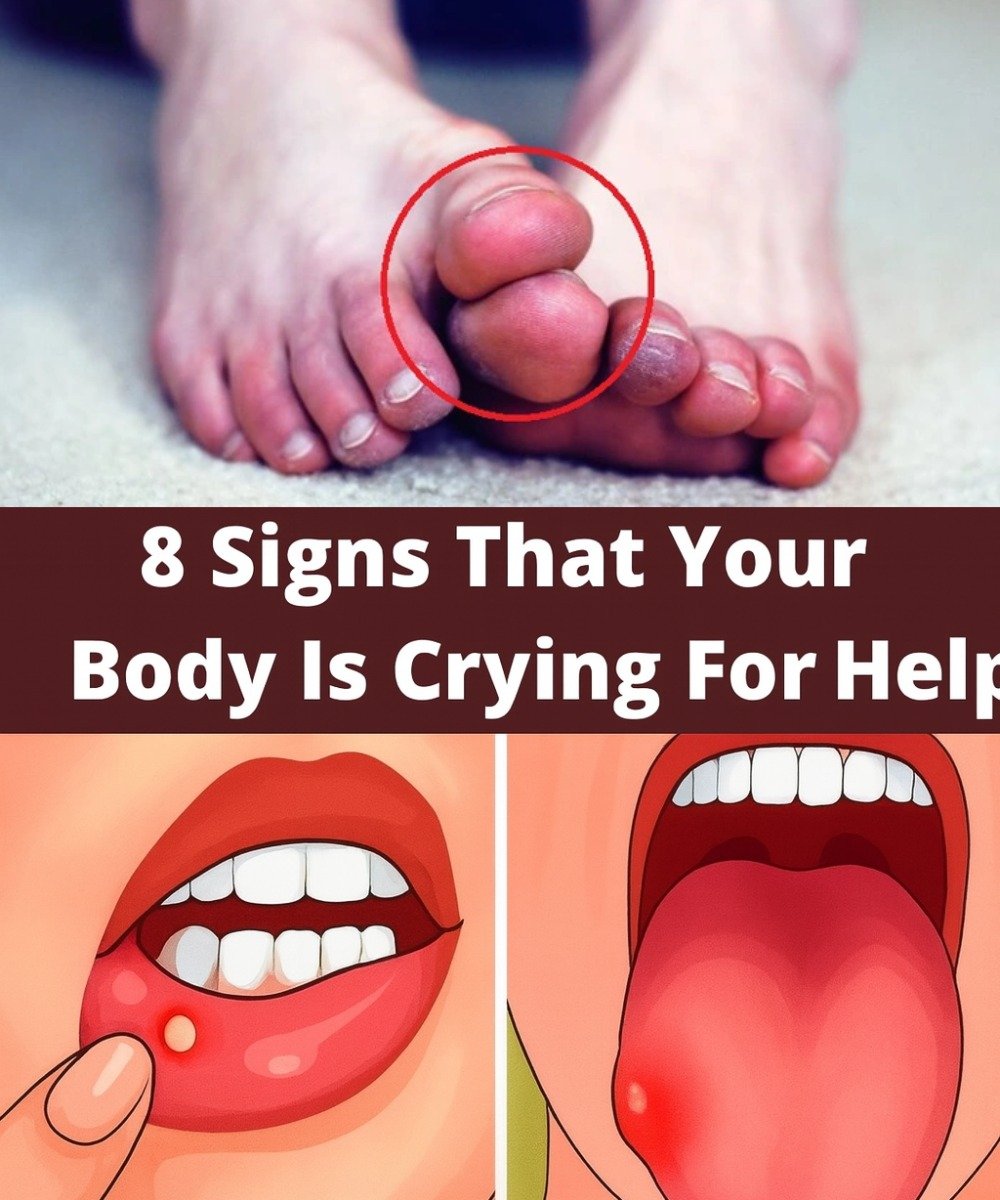  8 Silent Signals Your Body Is Screaming for Help