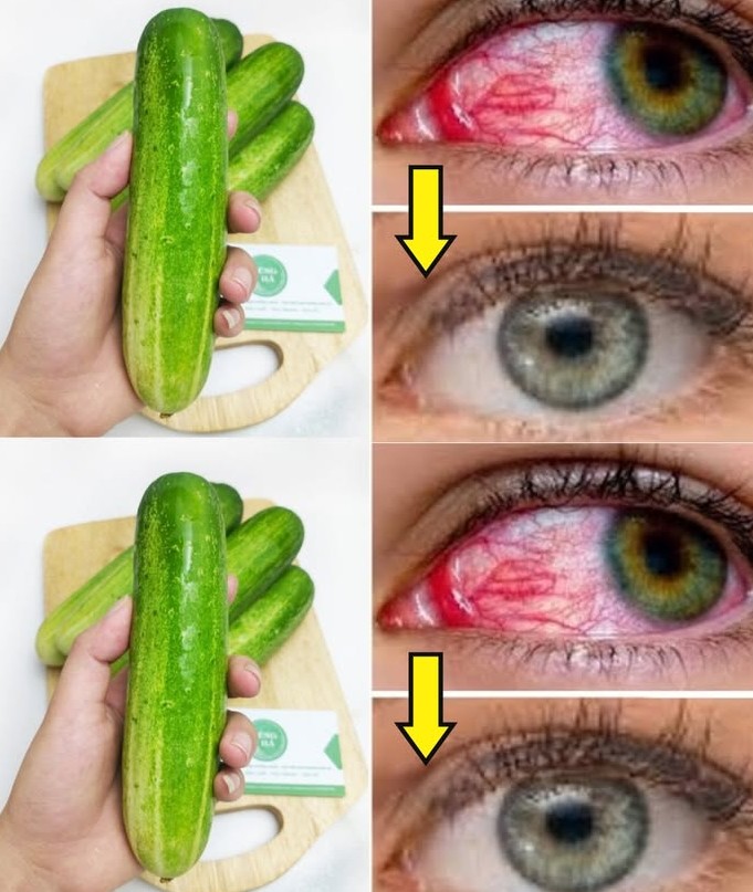 π₯ Refresh Your Vision: A Daily Cucumber Elixir for Enhanced Eyesight ππΏ