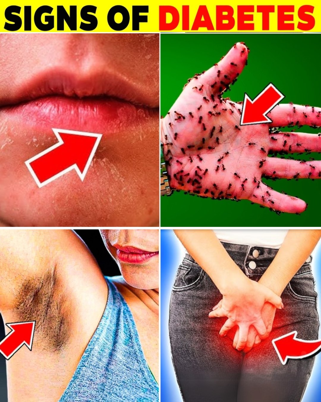 20 Silent Signs You May Have Diabetes Without Knowing