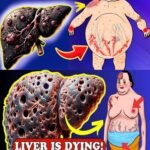 17 Silent Signs Your Liver Needs Help Now