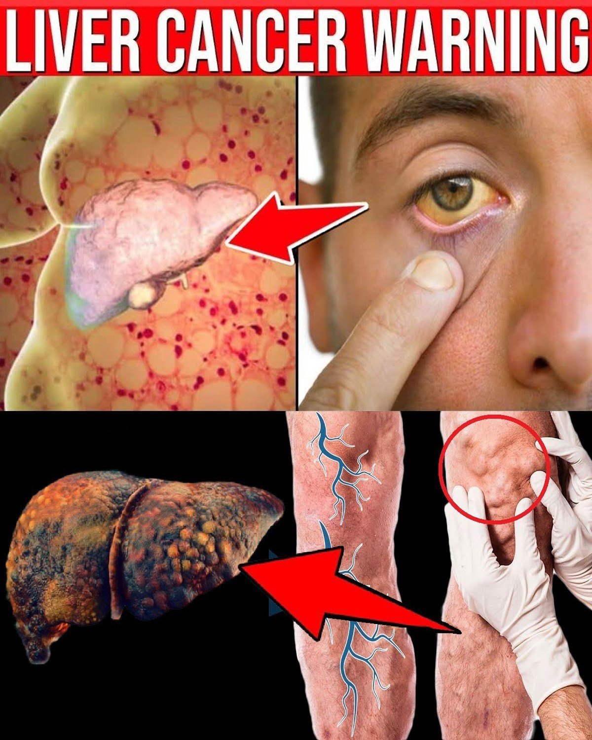 11 Early Liver Cancer Warning Signs You Must Never Ignore!