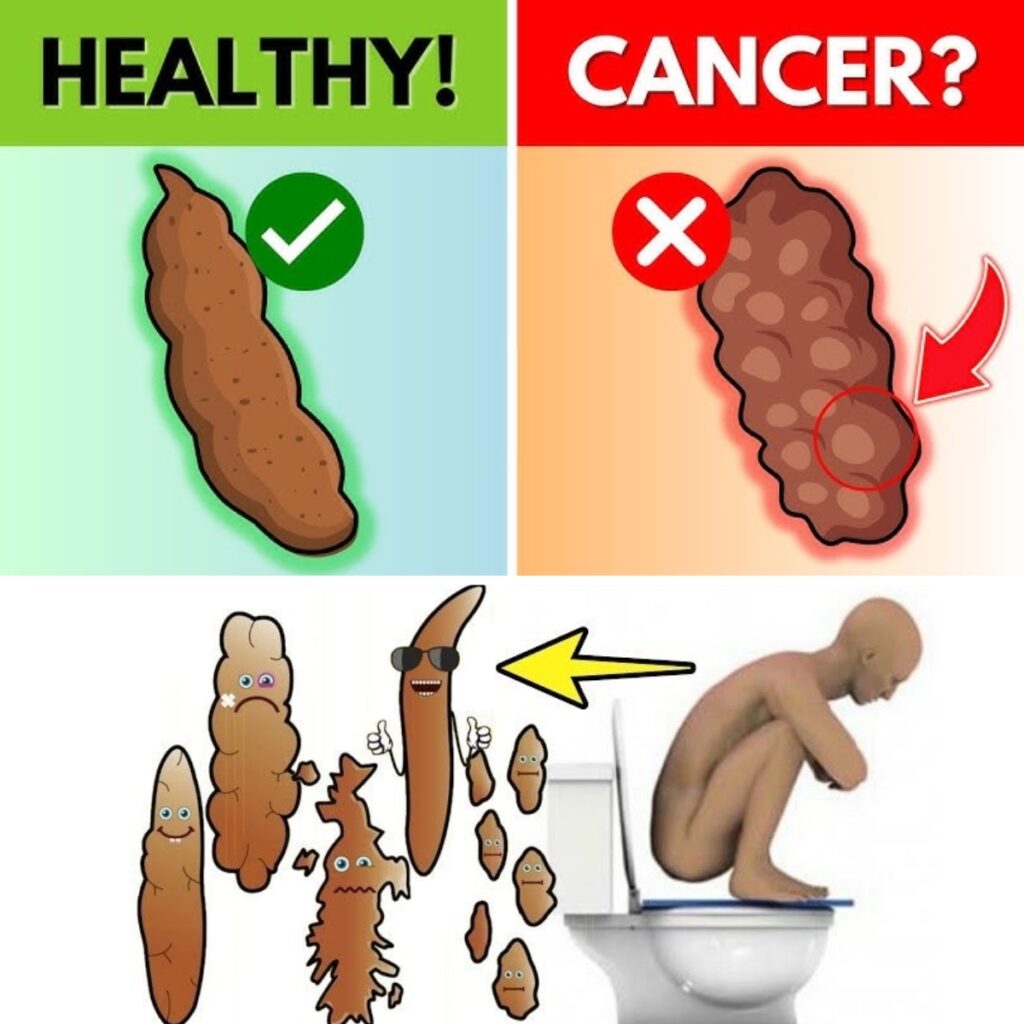 The Color of Your Stool Is Warning You About Your Health! (Check Your Poop Color!)
