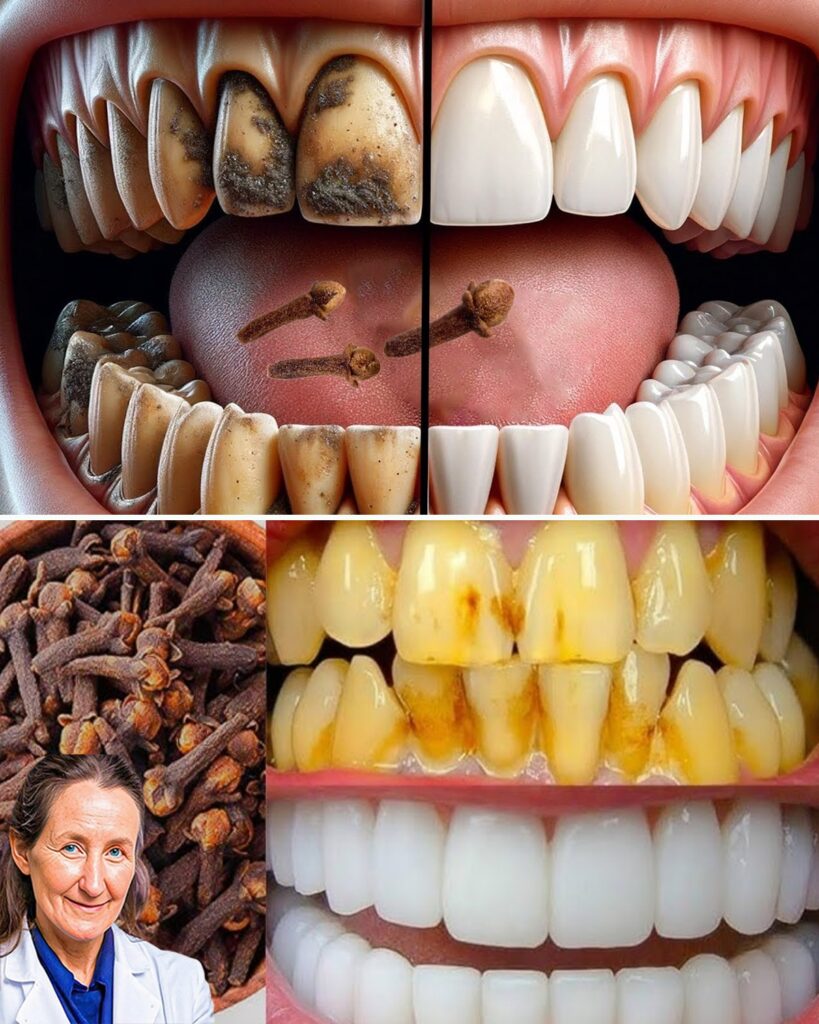 Discover Clove’s Hidden Power for a Healthier Smile