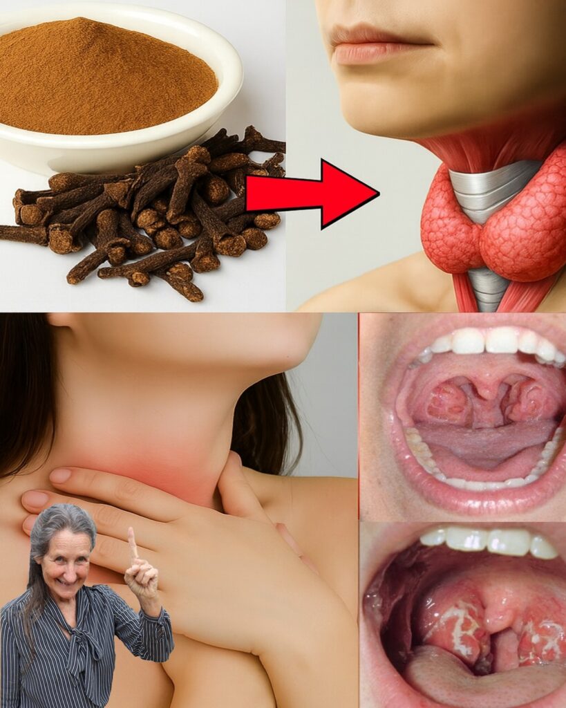 Cloves Unraveled: The Tiny Spice That Obliterates Sore Throats and Inflammation Overnight