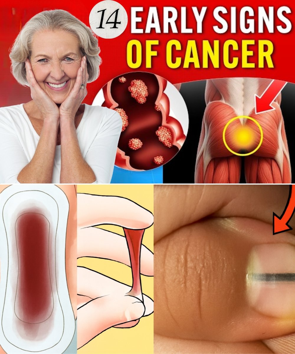 14 Visible Signs of Cancer Most Women Ignore
