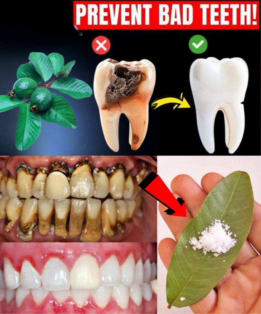 Top 3 Ways to Treat Tooth Decay with GuavaLeaves – Simple and Cost-Effective