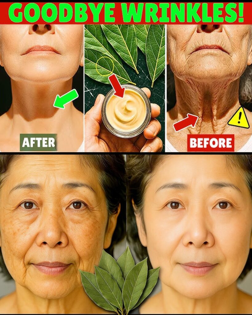 Erase Wrinkles Naturally: Bay Leaf’s Anti-Aging Power