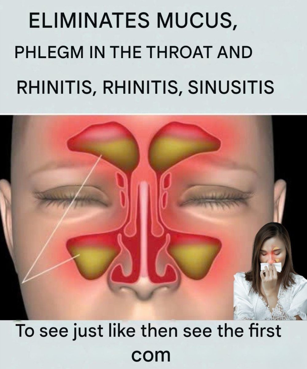 Eliminate Mucus, Phlegm in the Throat and Nose, and Rhinitis Naturally: Best Home Remedies