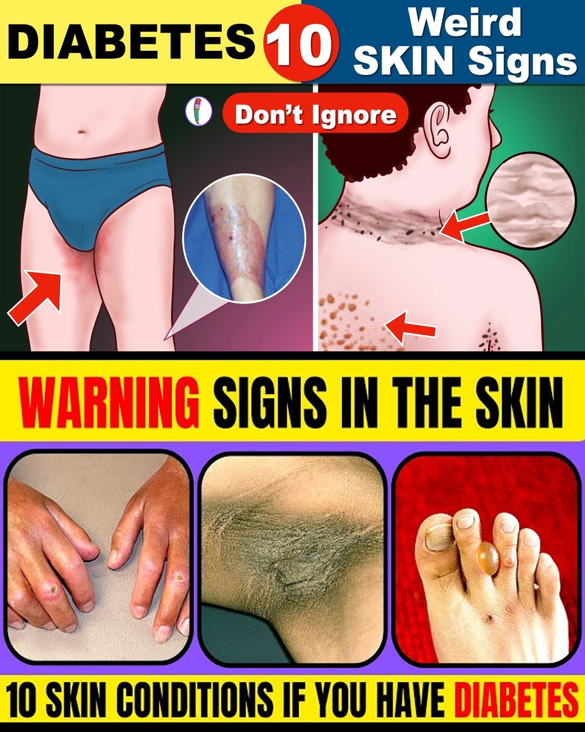 12 Unusual Diabetes Symptoms You Might Miss