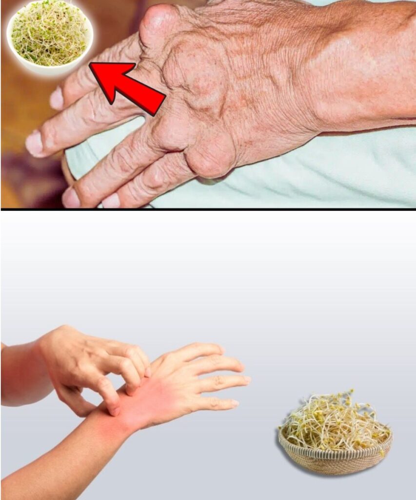 🌿 Alfalfa: A Natural Ally for Kidney Stones & Gout Relief