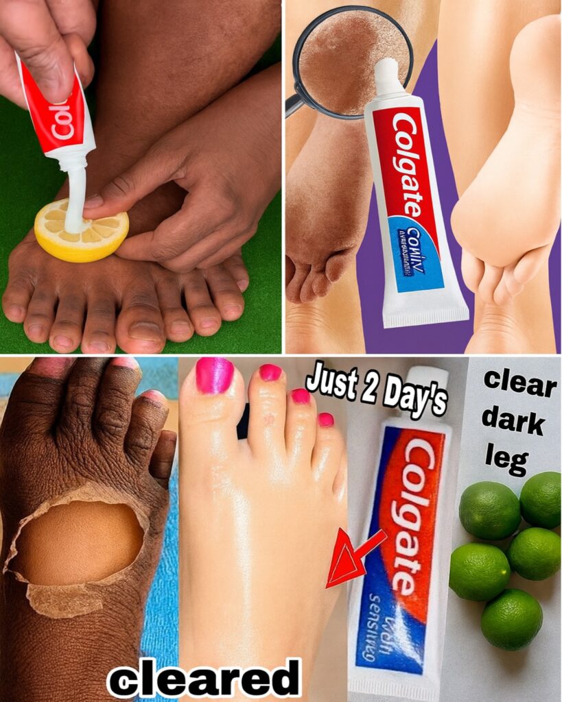 Rub Toothpaste on Your Feet for Surprising Health Wins