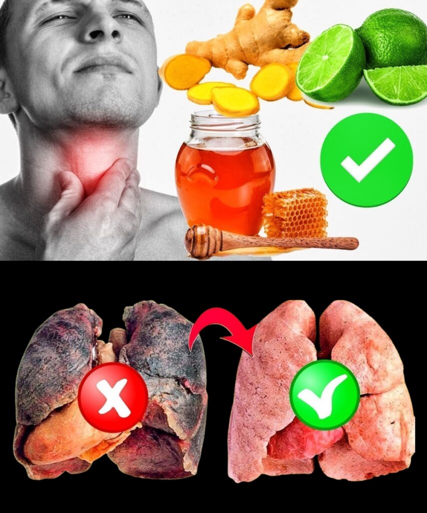 Say Goodbye to Hoarseness and Sore Throat: 5 Powerful Home Remedies to Cleanse Your Lungs and Soothe Cough Naturally